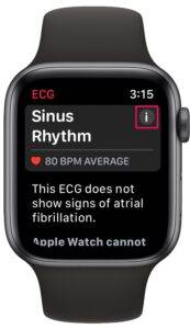 how-to-record-ecg-on-apple-watch-6-173x300-1